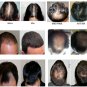 HAIR GROWTH Harifin 1 Finasteride 1mg. 30 tablets Free Shipping + tracking numbe