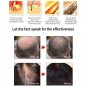 20ml Fast Powerful Hair Growth Essence Products Essential Oil Liquid Treatment
