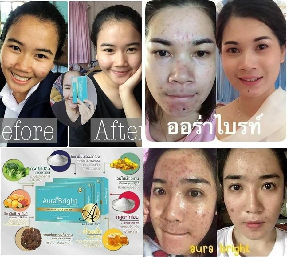 3X Aura Bright Super Premium Vitamin,Bright & Whitening Skin Anti-Aging