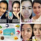 3X Aura Bright Super Premium Vitamin,Bright & Whitening Skin Anti-Aging