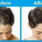 3 x Hair Growth Reten Five 5% Minoxidil Hair loss Beard Mustache Regrowth