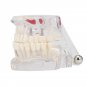 Professional Detachable Tooth Teeth Disease Moldel Dental Implant Display