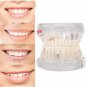 Professional Detachable Tooth Teeth Disease Moldel Dental Implant Display