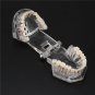 Professional Detachable Tooth Teeth Disease Moldel Dental Implant Display