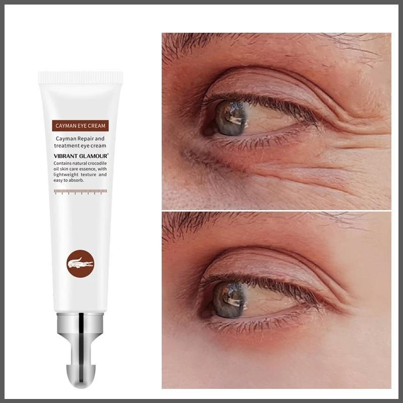 Anti-Aging Wrinkles Eye Cream