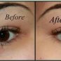 Aroma Magic Almond Under Eye Cream 20gm x 2 (Pack of 2)