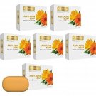 Richfeel Anti Acne Soap with Calendula Extracts 75gm x 6 (Pack of 6)