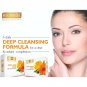 Richfeel Anti Acne Soap with Calendula Extracts 75gm x 6 (Pack of 6)