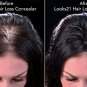 Livon Hair Gain Tonic, 150ml