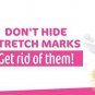 Mamaearth Body Creme for Stretch Marks and Scars, 100ml