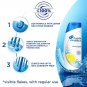 Head & Shoulders Anti Dandruff Lemon Fresh Shampoo, 360ml