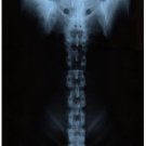 6244.X-ray of veriebrae.person's face in column POSTER.Home Office art