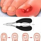 Professional Nail Correction Heavy Duty Thick Toe Nail Clippers Dead Skin Cutter