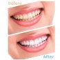 WHITE LIGHT SMILE Dental White hismile Kit Perfect Teeth Whitening Brighter