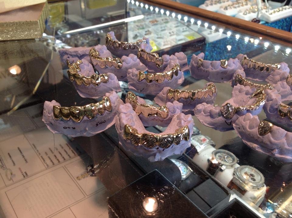 Gold Grills for your Teeth we mold them to fit your mouth Curlys has