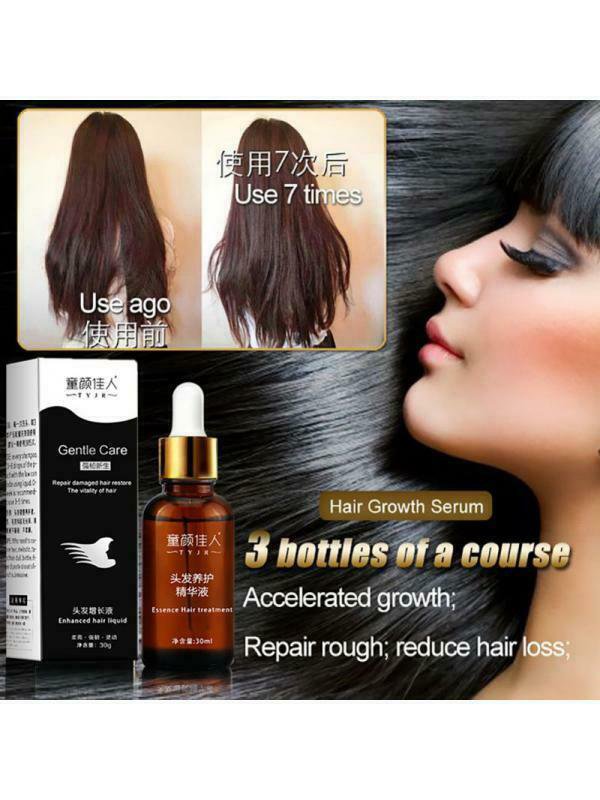 Hair Growth Essence Hair Loss Liquid 30ml Dense Hair Fast Sunburst Hair Growth G
