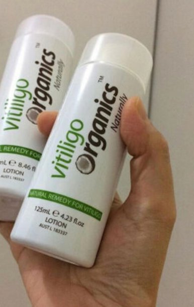 Vitiligo Organics for White Spots Patches Skin Repair RePigmentation 30ml