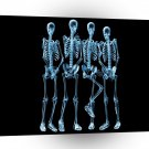 Abstract Skeletons Band Of Unknown A1 Xlarge Canvas