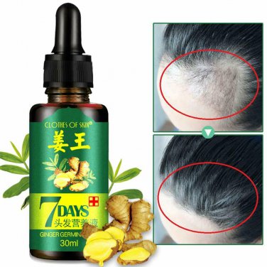 7 Day ReGrow Ginger Germinal Hair Growth Serum Hairdressing Oil Loss Treatment
