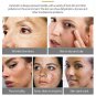 Crema Para Manchas En La Cara BLANQUEA Tu Piel Rápidamente Y OLVIDA Las Manchas