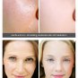Crema Para Manchas En La Cara BLANQUEA Tu Piel Rápidamente Y OLVIDA Las Manchas