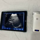 smartphone Wireless Portable Ultrasound Scanner Convex Array Probe 3.5Mhz