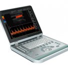 Color Doppler Portable Ultrasound Scanners CONVEX PROBE transducers