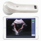 Portable Wireless Ultasound 4D Bladder Scanner urinary Accurate Measurement