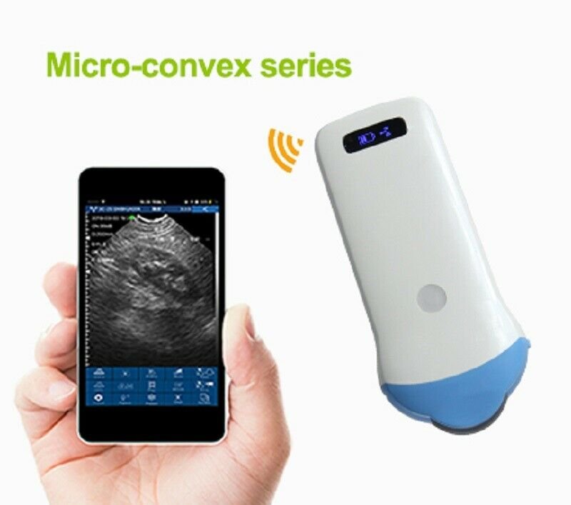 Handheld mini Wifi Wireless Portable Ultrasound Scanner MicroConvex Probe