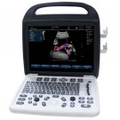 Color Doppler Portable Ultrasound Scanners EC-800