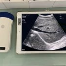 Portable Handheld mini Convex color doppler wireless ultrasound scanner probe