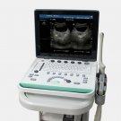 Portable Laptop Ultrasound Scanners WITH CONVEX PROBE transducers