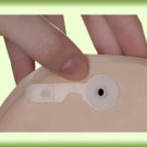 MCK Colostomy Lleostomy Vent Osto-EZ-Vent (Box of 10)