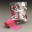 MCK Cast Tape Plus 2 Inch X 12 Foot Fiberglass Black