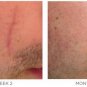 Kelo-cote Advanced Formula Scar Gel Imported from Germany Exp 07/2022