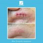 Kelo-cote Advanced Formula Scar Gel Imported from Germany Exp 07/2022
