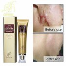 LanBeNa TCM Gel