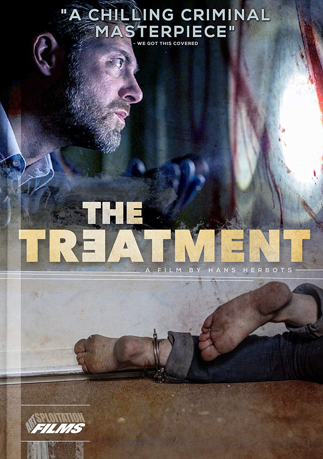 The Treatment [DVD] [2014]
