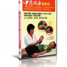 DT052-45 Chinese Medicine - Infantile Malnutrition, Fever and Muscular Torticolis DVD DT052-45 Chinese Medicine - Infantile Malnutrition, Fever and Muscular Torticolis DVD