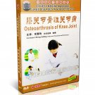 DT052-21 Chinese Medicine Massage Cures Diseases - Arthropathy Of Knee Joint DVD