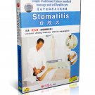 DT054-05 Simple Traditional Chinese medical massage & self health care - Stomatitis DVD DT054-05 Simple Traditional Chinese medical massage & self health care - Stomatitis DVD