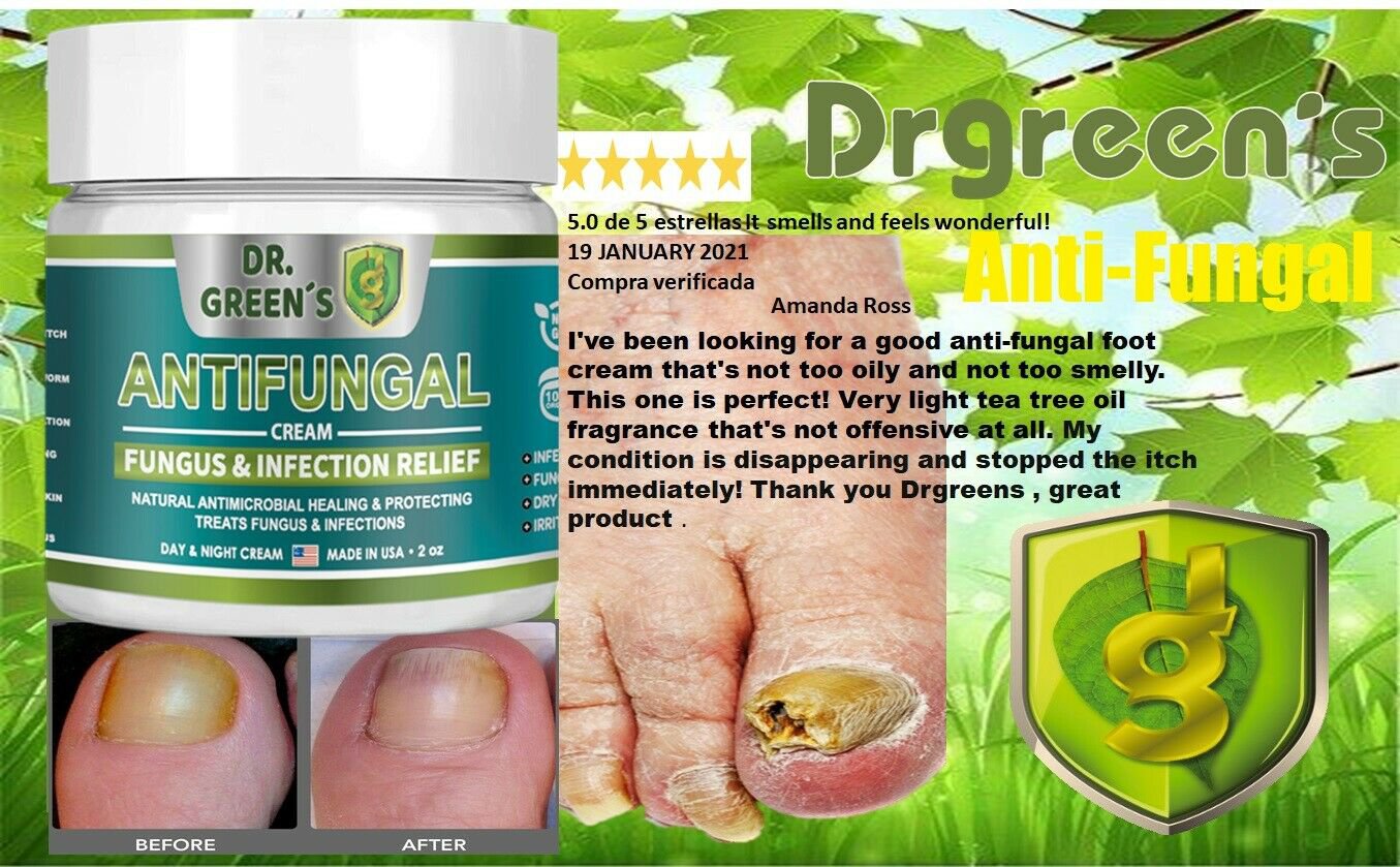 Jock Itch Tinea Itch Relief Cream Fast Treatment Herbal & Natural Ointment 2pk