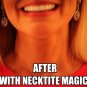 NeckTITE Magic - The Instant Neck Lift 1 pack
