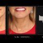 NeckTITE Magic - The Instant Neck Lift 1 pack