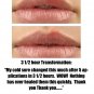 Thyme Out The Knockout Alternative For Eczema, Psoriasis, Acne, Dermatitis, R...