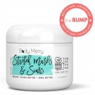 Stretch Marks & Scars Defense Cream Daily Moisturizer w Organic Cocoa Butter ...