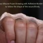 Silicone Foam Dressing with Border (Adhesive) Waterproof 4" X 4" (10 cm X 10 ...