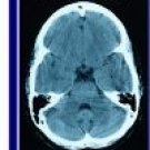 Using Neuro Linguistic Programming (NLP) on eBay
