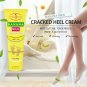 Feet Remove Dead Skin Soften Foot Anti-Drying Cracked Heel Callus Repair Cream