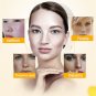 Whitening Freckle Cream Face Moisturizing Remove Dark Spots Melanin Melasma Remo